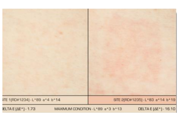 Skin Whitening Raw Cosmetic Ingredients Hydroxypinacolone Retinoate HPR P CAS 893412-73-2 2